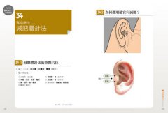 古典經絡針灸大家：周左宇醫道精要（附6小時錄音教學光碟） 圖片 6